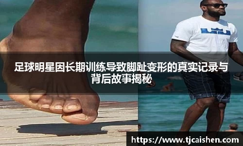 足球明星因长期训练导致脚趾变形的真实记录与背后故事揭秘